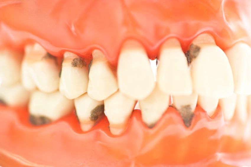 Clínica de Periodoncia en Gijón Clínica de Periodoncia en Gijón