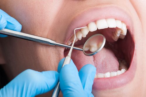 revisión implantes dentales Gijó